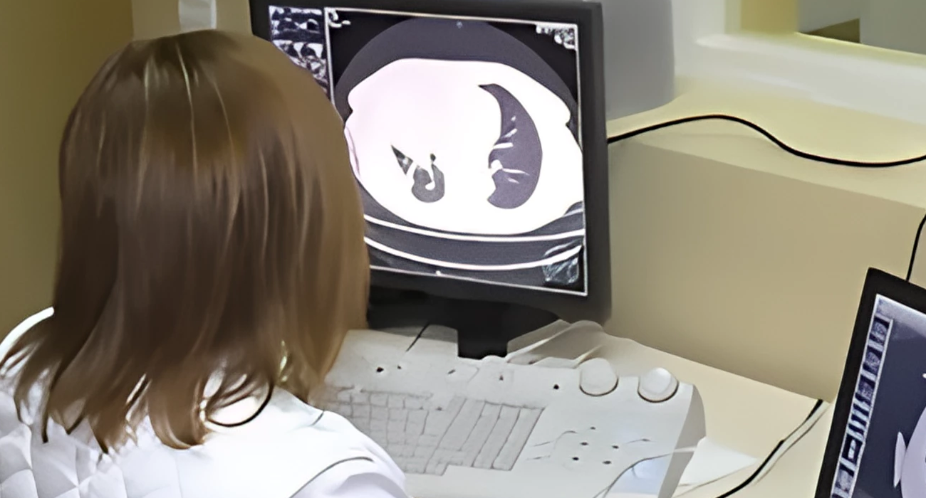 Компьютерна томографія